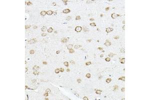 Immunohistochemistry of paraffin-embedded rat brain using [KO Validated] SCD Rabbit pAb (ABIN7270589) at dilution of 1:100 (40x lens). (SCD anticorps  (C-Term))