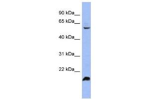 WB Suggested Anti-SFRS4 Antibody Titration:  0.