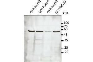 Western Blotting (WB) image for anti-RAB10, Member RAS Oncogene Family (RAB10) (C-Term) antibody (ABIN6254238)