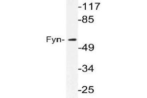Western blot (WB) analysis of Fyn antibody in extracts from MCF-7 cells. (FYN anticorps)