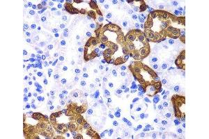 Immunohistochemistry of paraffin-embedded Rat kidney using KRT19 Polyclonal Antibody at dilution of 1:100 (40x lens).