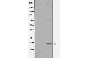 Western blot analysis of extracts of 293, using REG3A antibody. (REG3A anticorps  (Internal Region))