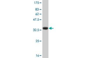 Western Blot detection against Immunogen (31. (IL-8 anticorps  (AA 21-99))