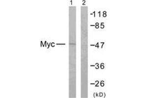 Western blot analysis of extracts from NIH-3T3 cells, treated with EGF 200ng/ml 30', using MYC (Ab-358) Antibody. (c-MYC anticorps  (AA 325-374))