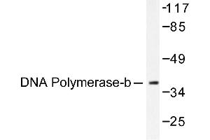 Image no. 1 for anti-Polymerase (DNA Directed), beta (POLB) antibody (ABIN265385) (POLB anticorps)