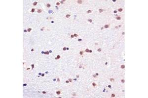 IHC testing of FFPE monkey brain tissue with TBP antibody at 1:25 dilution. (TBP anticorps)