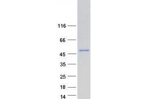 Validation with Western Blot