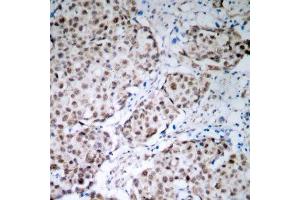 Immunohistochemistry (IHC) image for anti-Tumor Protein P53 (TP53) (pSer315) antibody (ABIN3020520) (p53 anticorps  (pSer315))