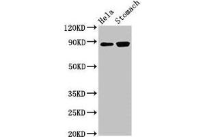 Western Blot Positive WB detected in: Hela whole cell lysate, Rat stomach tissue All lanes: ASAH2 antibody at 3 μg/mL Secondary Goat polyclonal to rabbit IgG at 1/50000 dilution Predicted band size: 86, 82 kDa Observed band size: 86 kDa (ASAH2 anticorps  (AA 255-506))
