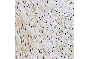 Immunohistochemistry of paraffin-embedded mouse heart using R Rabbit mAb (ABIN7269844) at dilution of 1:100 (40x lens).