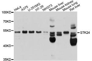 Western blot analysis of extracts of various cell lines, using STK24 antibody.