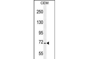 STIM1 Antibody (C-term) (ABIN654073 and ABIN2843969) western blot analysis in CEM cell line lysates (35 μg/lane). (STIM1 anticorps  (C-Term))