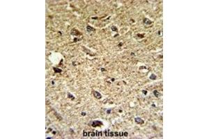 Immunohistochemistry (IHC) image for anti-CCR4 Carbon Catabolite Repression 4-Like (CCRN4L) antibody (ABIN3002711)