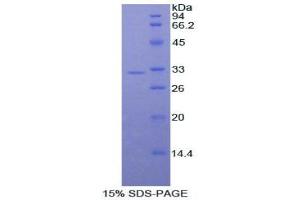 SDS-PAGE analysis of Dog ALCAM Protein.