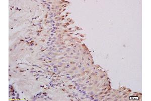 Formalin-fixed and paraffin embedded rat ovary tissue labeled with Anti A1BG Polyclonal Antibody,Unconjugated (ABIN872952) at 1:200 followed by conjugation to the secondary antibody and DAB staining. (A1BG anticorps  (AA 301-400))
