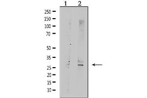 Western blot analysis of extracts from rat muscle, using TNFRSF10C  Antibody. (DcR1 anticorps)