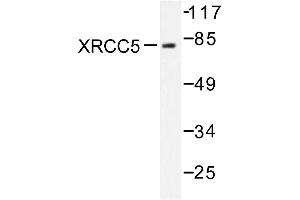 Image no. 1 for anti-X-Ray Repair Complementing Defective Repair in Chinese Hamster Cells 5 (Double-Strand-Break Rejoining) (XRCC5) antibody (ABIN271983) (XRCC5 anticorps)