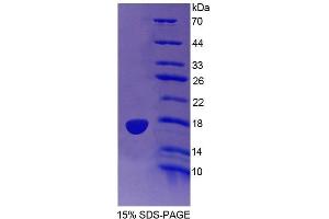 SDS-PAGE (SDS) image for Indoleamine 2,3-Dioxygenase 2 (IDO2) (AA 84-228) protein (His tag) (ABIN1099170) (IDO2 Protein (AA 84-228) (His tag))