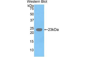 Western blot analysis of the recombinant protein. (GDF3 anticorps  (AA 251-364))