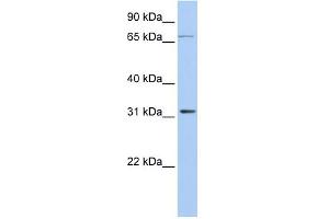 WB Suggested Anti-IDI1 Antibody Titration: 0. (IDI1 anticorps  (Middle Region))