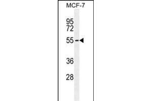 PCA Antibody (C-term) (ABIN655112 and ABIN2844743) western blot analysis in MCF-7 cell line lysates (35 μg/lane). (PMPCA anticorps  (C-Term))