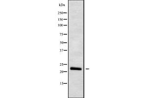 Western blot analysis IFNW1 using HUVEC whole cell lysates (IFNW1 anticorps  (C-Term))