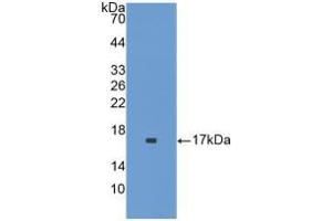 Western blot analysis of recombinant Mouse IL1F9. (IL1F9 anticorps  (AA 5-149))