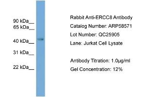 WB Suggested Anti-ERCC8  Antibody Titration: 0. (ERCC8 anticorps  (Middle Region))