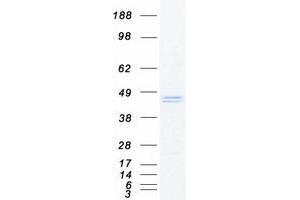 Validation with Western Blot