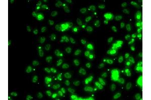 Immunofluorescence analysis of HeLa cells using SECISBP2 antibody (ABIN5974073). (SECISBP2 anticorps)
