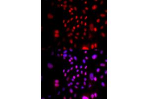Immunofluorescence analysis of U2OS cells using RFC4 antibody (ABIN5973195). (RFC4 anticorps)