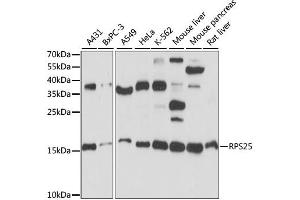 Western blot analysis of extracts of various cell lines, using RPS25 antibody. (RPS25 anticorps)