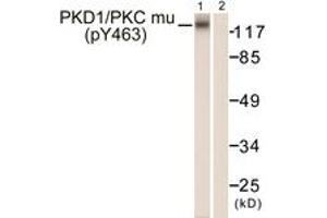 Western blot analysis of extracts from HepG2 cells, using PKD1/PKC mu (Phospho-Tyr463) Antibody. (PKC mu anticorps  (pTyr463))