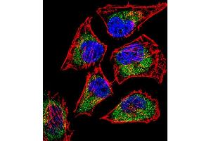Fluorescent confocal image of Hela cell stained with SIX5 Antibody (Center) (ABIN656668 and ABIN2845908). (Six5 anticorps  (AA 257-286))