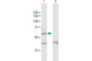 Western Blot analysis of ZNF92 expression in transfected 293T cell line by ZNF92 MaxPab polyclonal antibody. (ZNF92 anticorps  (AA 1-517))
