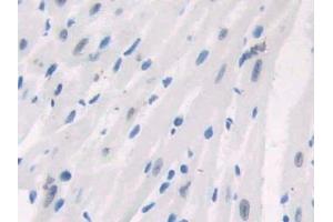Detection of PARP in Mouse Cardiac Muscle Tissue using Polyclonal Antibody to Poly ADP Ribose Polymerase (PARP)