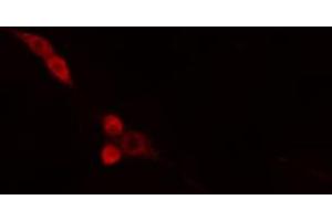 ABIN6274665 staining HepG2 cells by IF/ICC.
