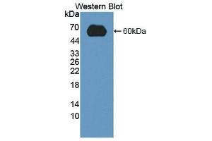 Western Blotting (WB) image for anti-Low Density Lipoprotein Receptor (LDLR) (AA 263-509) antibody (ABIN1868940) (LDLR anticorps  (AA 263-509))