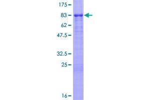 Vitronectin (VTN) (AA 1-478) protein (GST tag)