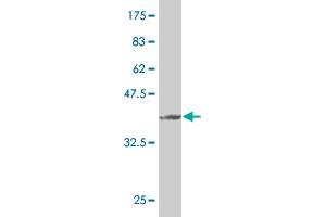 Western Blot detection against Immunogen (37 KDa) .