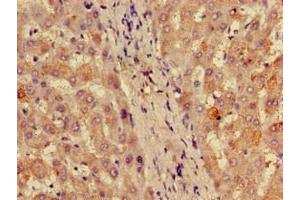 Immunohistochemistry of paraffin-embedded human liver tissue using ABIN7142793 at dilution of 1:100 (RPL28 anticorps  (AA 2-137) (Biotin))