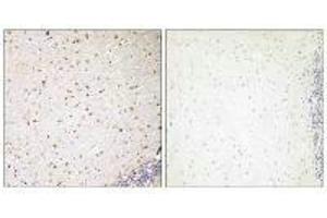 Immunohistochemistry analysis of paraffin-embedded human brain tissue, using PAK7 antibody.