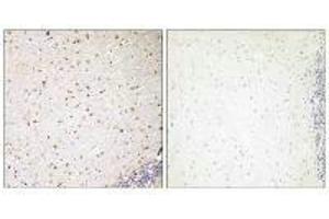Immunohistochemistry analysis of paraffin-embedded human brain tissue, using PAK7 antibody. (PAK7 anticorps  (C-Term))