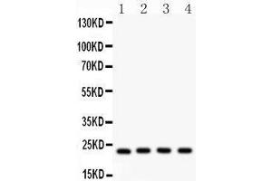 Anti- BAK Picoband antibody, Western blotting All lanes: Anti BAK  at 0. (BAK1 anticorps  (AA 22-211))