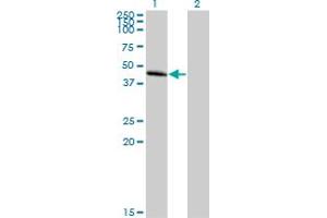 Western Blot analysis of CCBP2 expression in transfected 293T cell line by CCBP2 MaxPab polyclonal antibody. (CCBP2 anticorps  (AA 1-384))