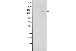 Western blot analysis of FGFR1 phosphorylation expression in Insulin treated 293 whole cell lysates,The lane on the left is treated with the antigen-specific peptide. (FGFR1 anticorps  (pTyr654))