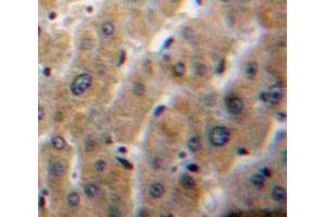IHC-P analysis of Liver tissue, with DAB staining. (PLA1A anticorps  (AA 148-295))
