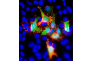 Immunofluorescent analysis of GFP using either natural fluorescence (green) or an GFP antibody (red) in Hela(human cervical epithelial adenocarcinoma cell line) cells transfected with GFP recombinant protein. (GFP Tag anticorps)