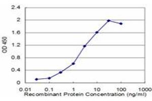 Detection limit for recombinant GST tagged RAB27A is approximately 0. (RAB27A anticorps  (AA 122-221))