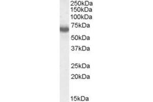 Western Blotting (WB) image for anti-IKAROS Family Zinc Finger 1 (Ikaros) (IKZF1) (AA 436-450) antibody (ABIN490467) (IKZF1 anticorps  (AA 436-450))